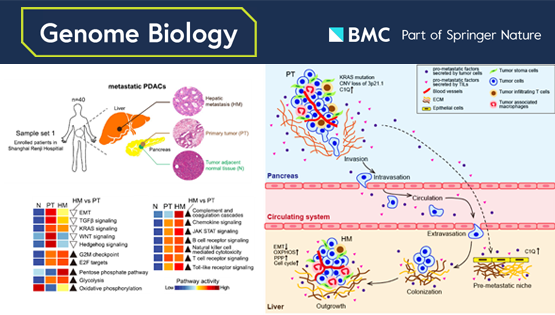 李虹、李亦學(xué)研究組合作破譯胰腺癌肝轉(zhuǎn)移的分子特征